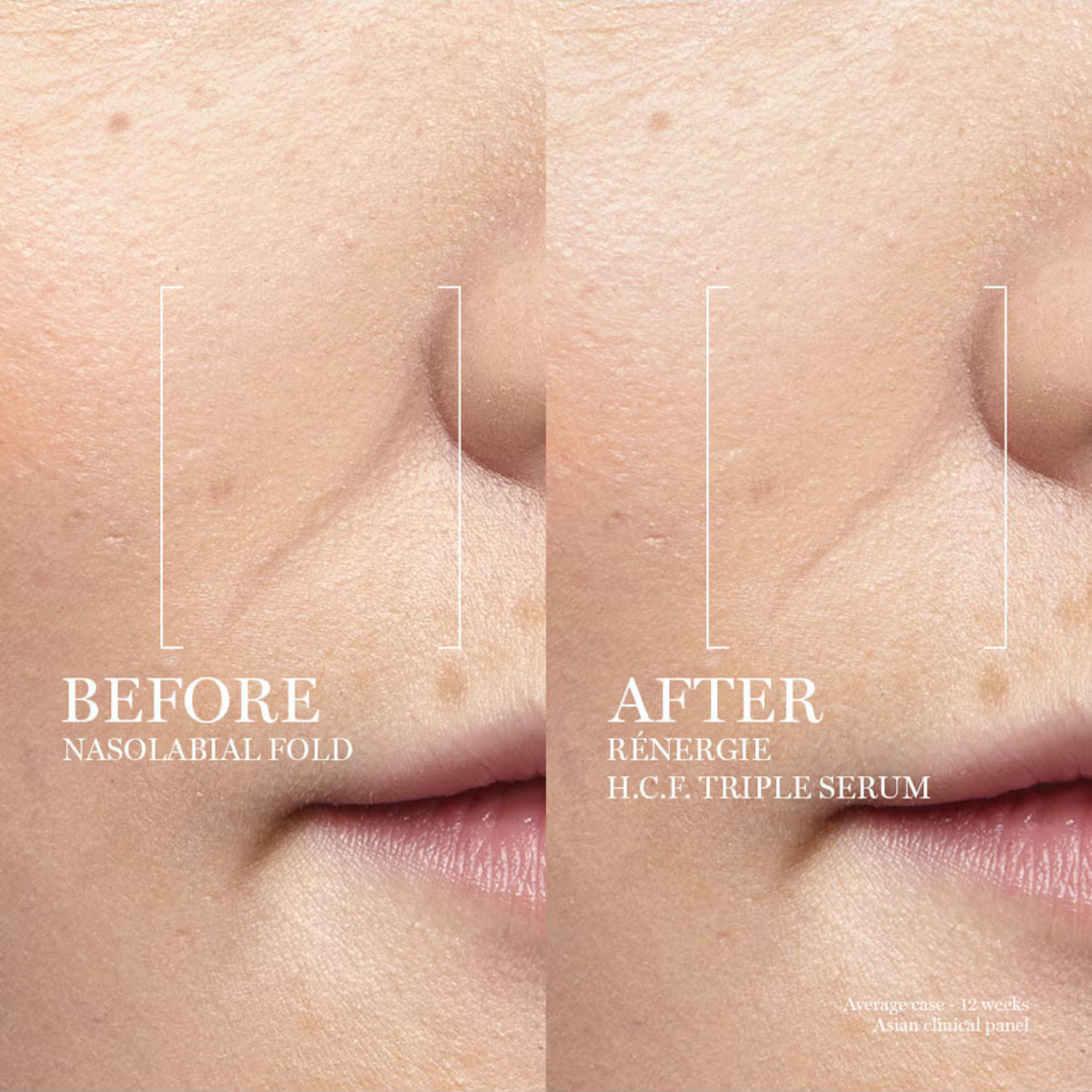 Lancôme Rénergie H.C.F. Triple Serum - 20 ml